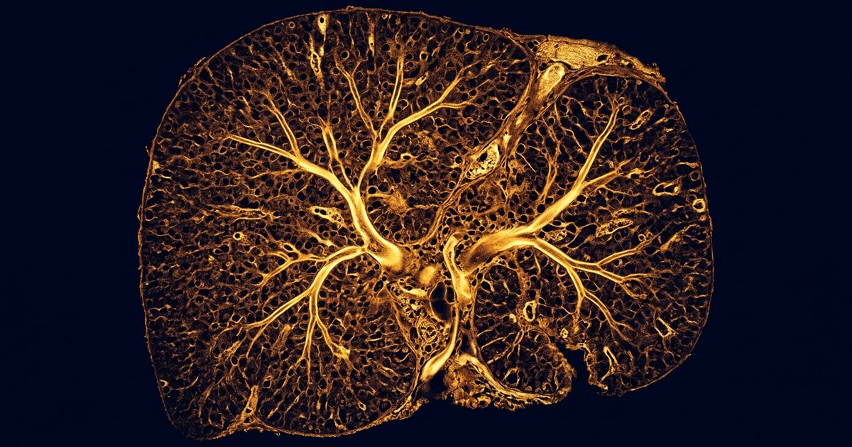 Where TUDCA's Liver Trial Data Actually Comes From - TUDCAHub
