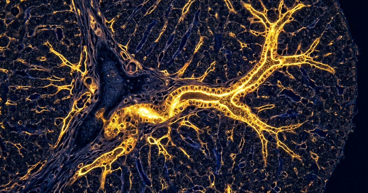 Neuroprotective Potential: From ALS to Alzheimer's - TUDCAHub