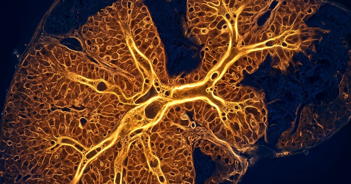 Where TUDCA Fits: Cholestasis Versus General Digestive Symptoms - TUDCAHub