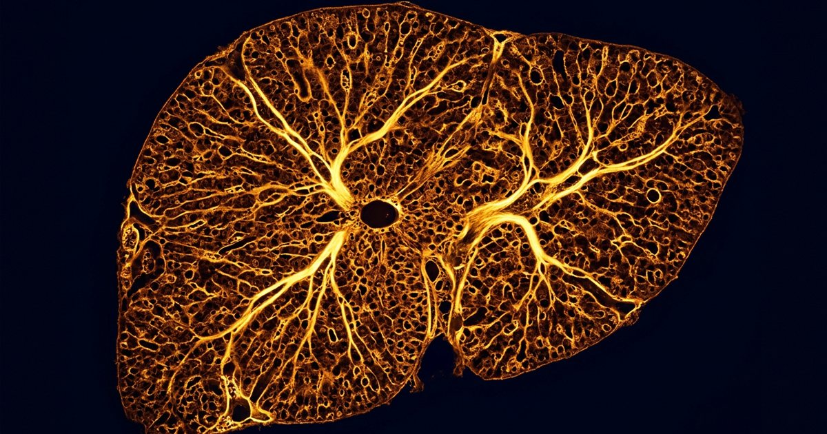 TUDCA and Oxidative Stress in the Retinal Pigment Epithelium - TUDCAHub